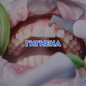 Профессиональная чистка зубов