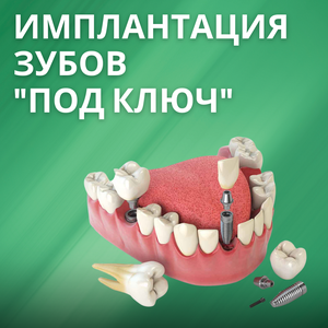 Имплантация зубов "под ключ" от