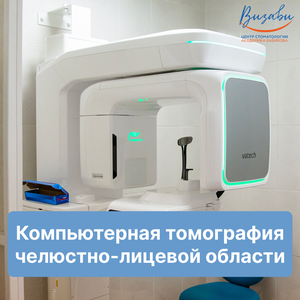 Компьютерная томография зубов