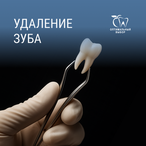  Удаление зуба от 