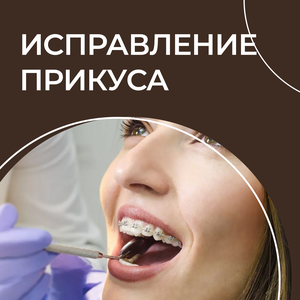 Исправление прикуса