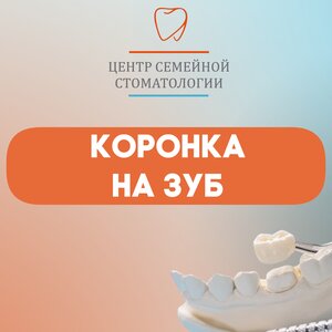 Коронка на зуб от