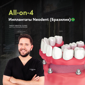 Имплантация All-on-4
