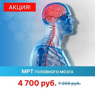 МРТ головного мозга
