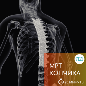 МРТ копчика