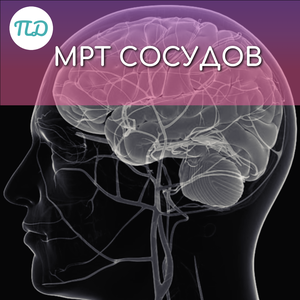 МРТ сосудов