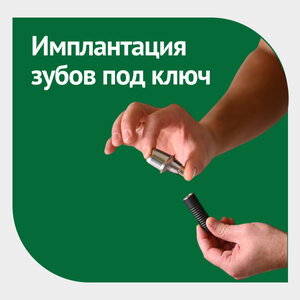 Имплантация зубов «‎под ключ»