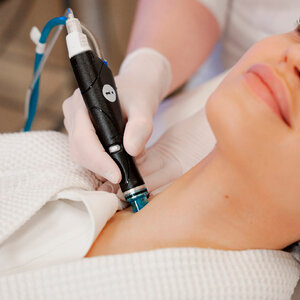 HydraFacial: глубокое очищение, увлажнение и омоложение
