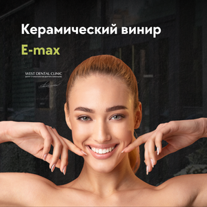 Керамический винир E-max