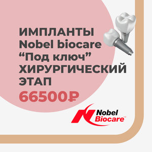 Акция! Имплантация Nobel Biocare в КДС Дентал