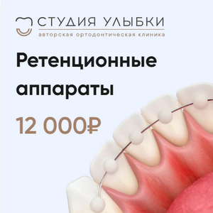 Ретенционные аппараты