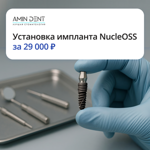 Установка импланта NucleOSS