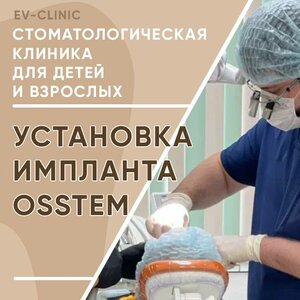 Установка классического винтового импланта Osstem