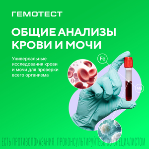 Общие анализы крови и мочи