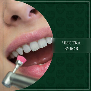 Чистка зубов 