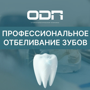 Отбеливание зубов от