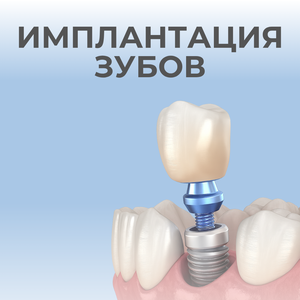 Имплантация зубов от 