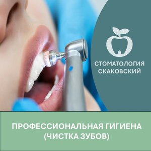 Чистка зубов. Современная стоматология "Скаковский". При
