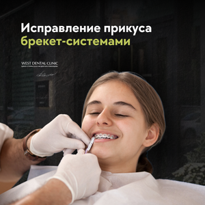 Исправление прикуса брекет-системами 