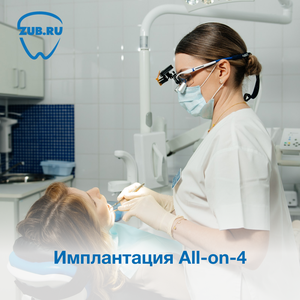 Имплантация All-on-4
