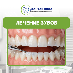 Лечение зубов 