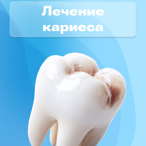 Лечение кариеса от 5900