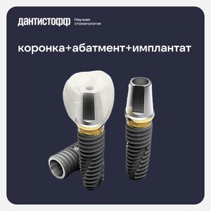 Имплантация Osstem с циркониевой коронкой «под ключ»