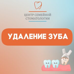 Удаление зуба от