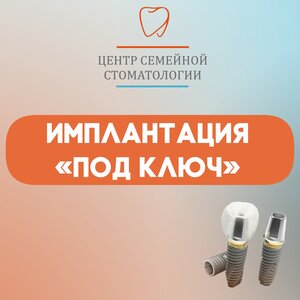 Имплантация зуба "Под ключ" от