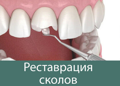 Реставрация зубов