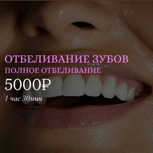 Полное косметическое отбеливание зубов