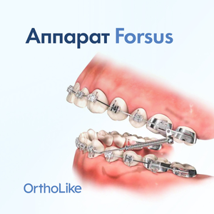Аппарат Forsus