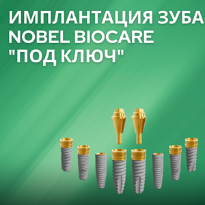 Имплантация зуба "Nobel biocare" "под ключ" 