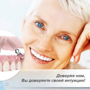 Все на 4 (зубы под ключ) от