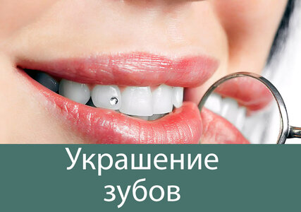 Установка украшений на зубы