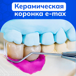 Коронка цельнокерамическая на имплантате «под ключ»