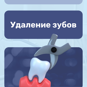 Удаление зубов без боли и стресса 