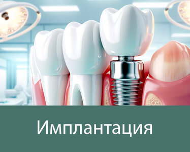 Установка импланта