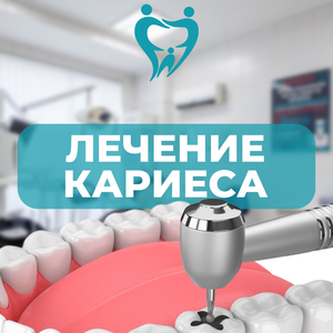 Лечение кариеса