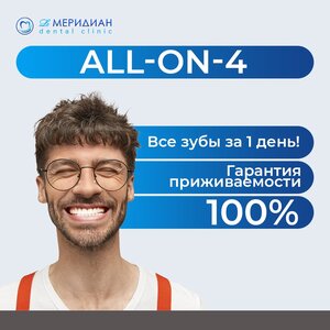 Имплантации all-on-4