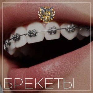 Брекеты на 2 челюсти от 