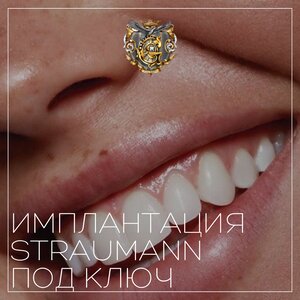 Имплантация Straumann под ключ