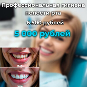 Акция на проф. гигиену!