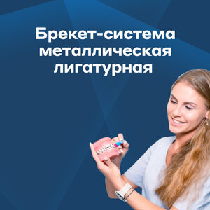 Брекет-система металлическая лигатурная 