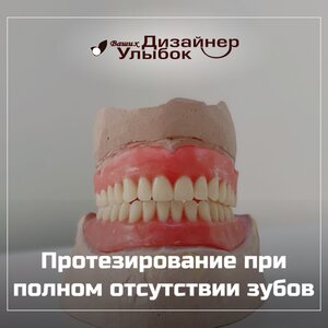 Протезирование при полном отсутствии зубов от