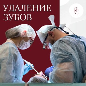 Удаление зубов