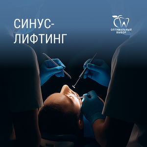 Синус-лифтинг от 