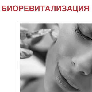 Биоревитализация от