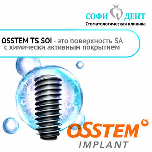 Установка имплантата «TS soi Osstem» (Южная Корея)