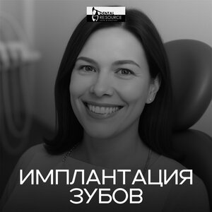 Имплантация зубов от